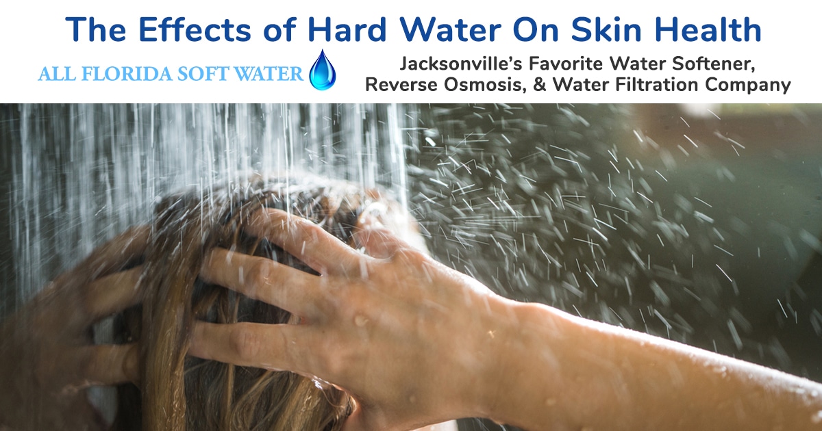 hard water skin health jacksonville florida